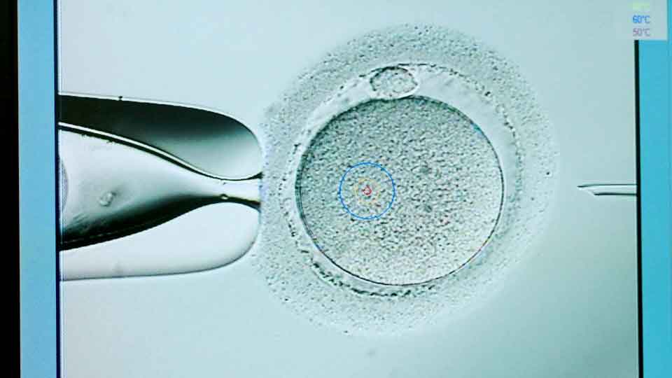 Fecundación In Vitro (FIV): Una Guía Completa