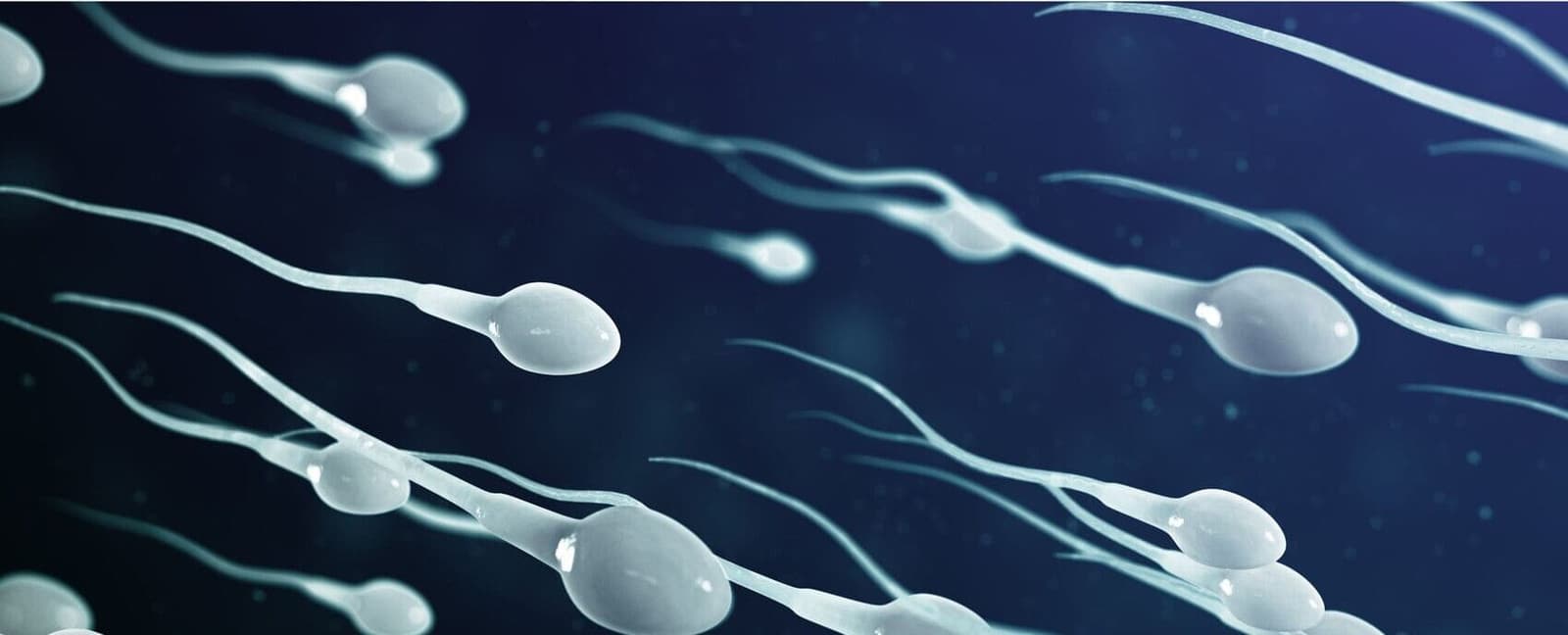 Testicular biopsy to detect the origin of male infertility