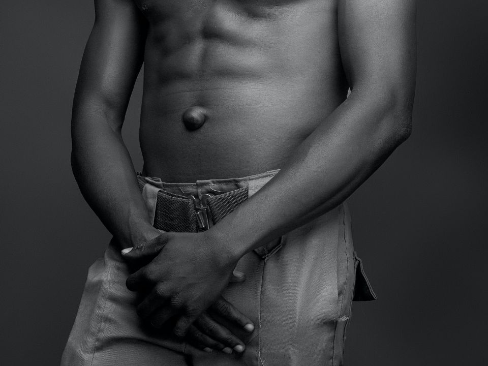 Erectile dysfunction and fertility