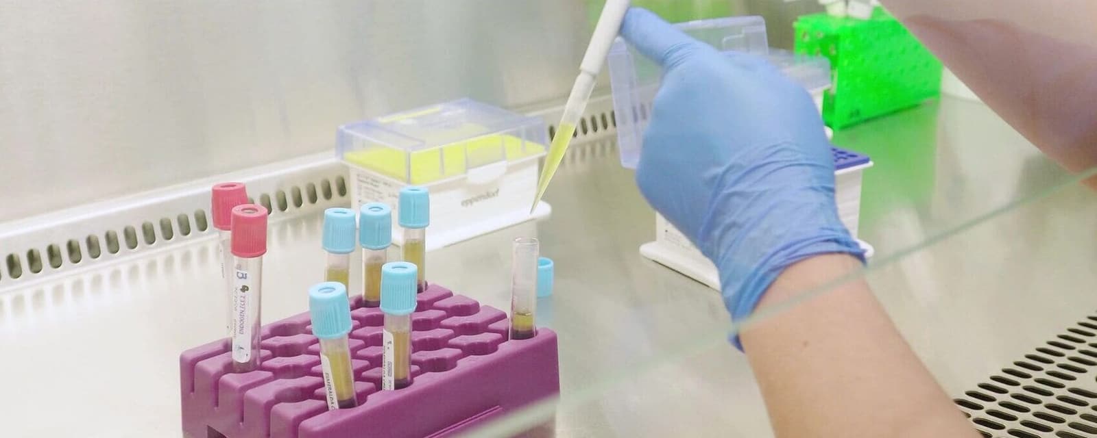 Ovagen®: Una Alternativa Para Mujeres Con Baja Respuesta Ovárica