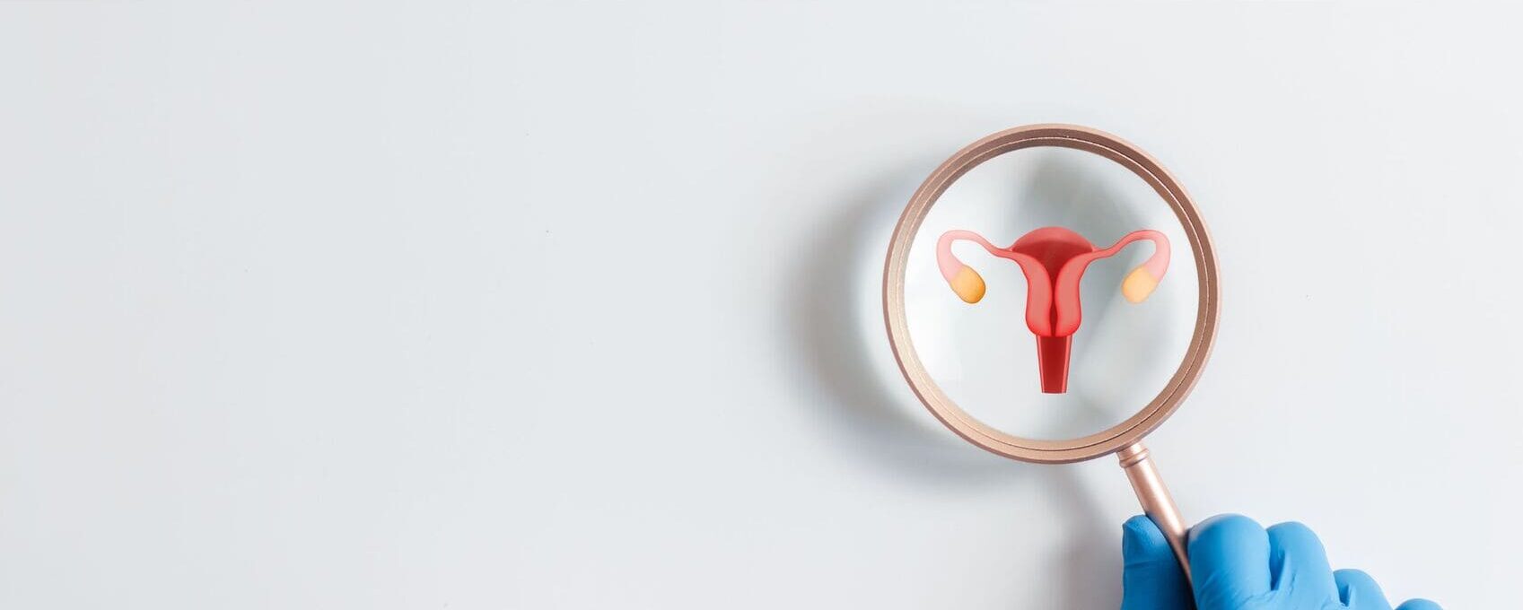 Miomas, pólipos y adenomiosis: cuándo sí afectan la implantación y cuándo no