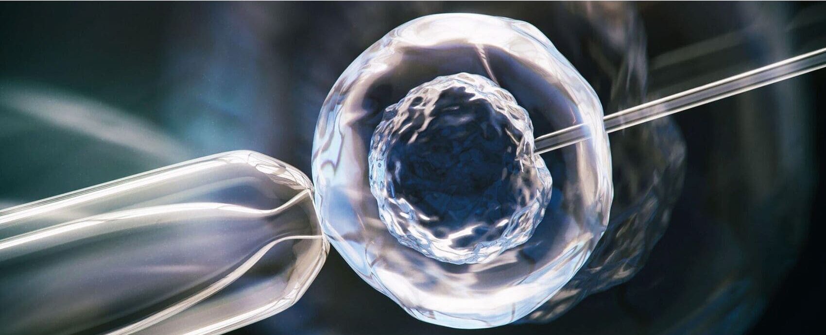 Fecundación In Vitro en casos complejos: cómo un enfoque multinivel ayudó a lograr un embarazo