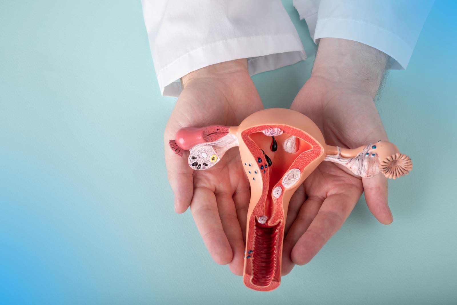 Médico sosteniendo en sus manos un modelo anatómico del útero, las trompas y los ovarios