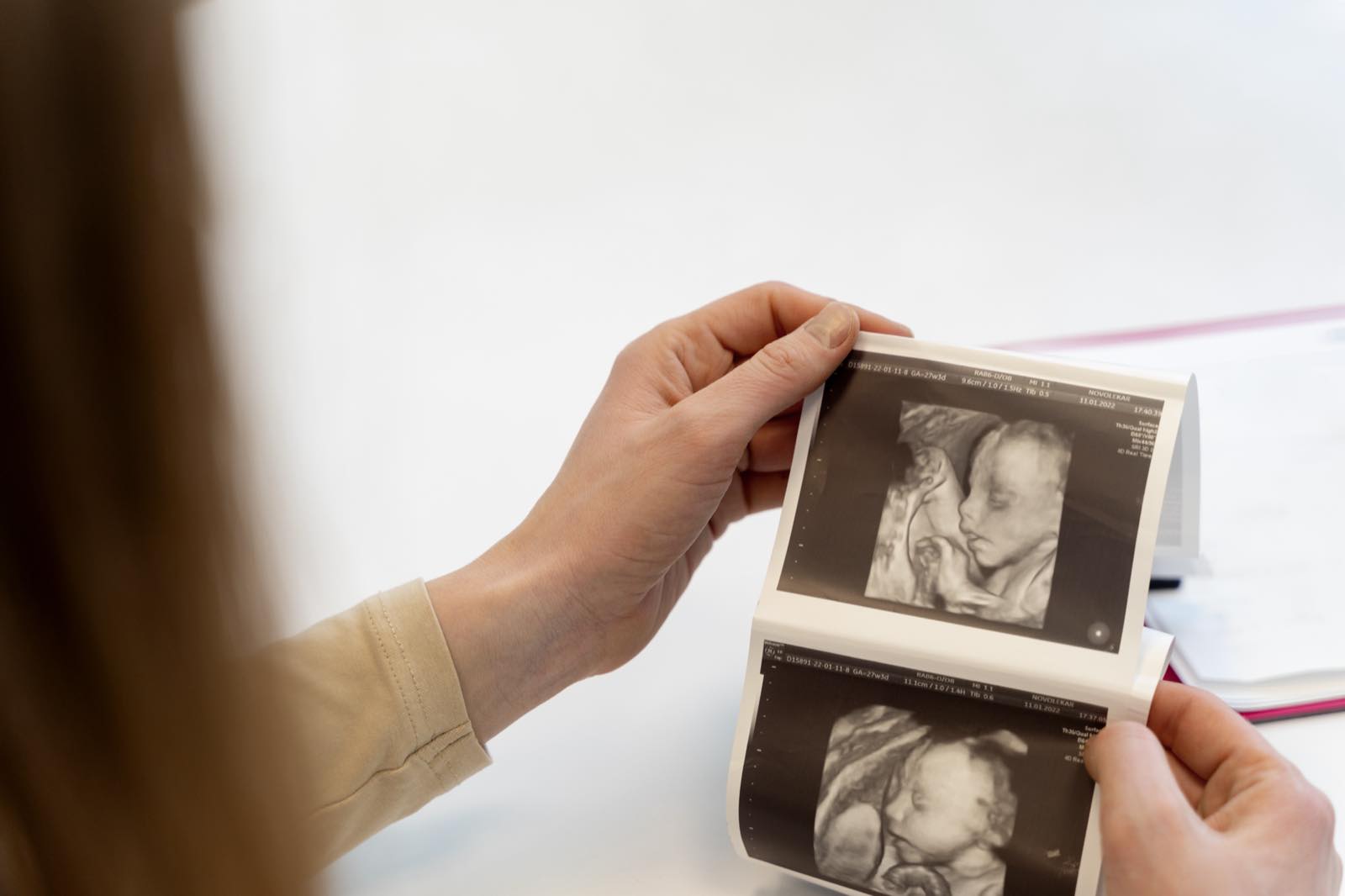Woman holding printed pregnancy ultrasound images