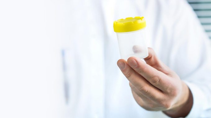 Recipiente para muestra de semen en inseminación artificial