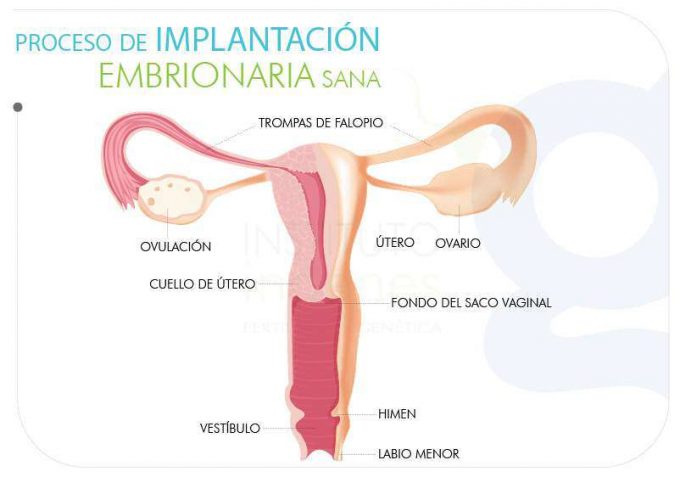ilustración de aparato reproductor femenino y proceso de implantación