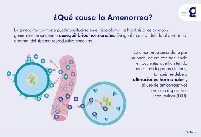 causas amenorrea