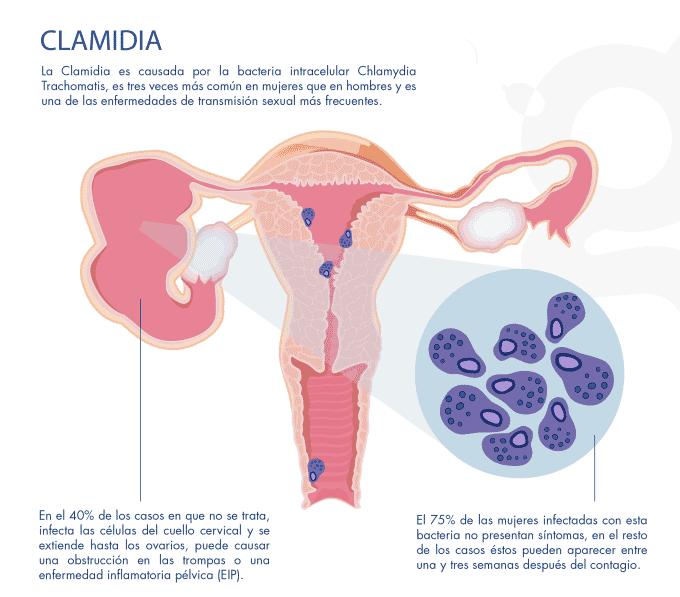 Imagen vacuna clamidia