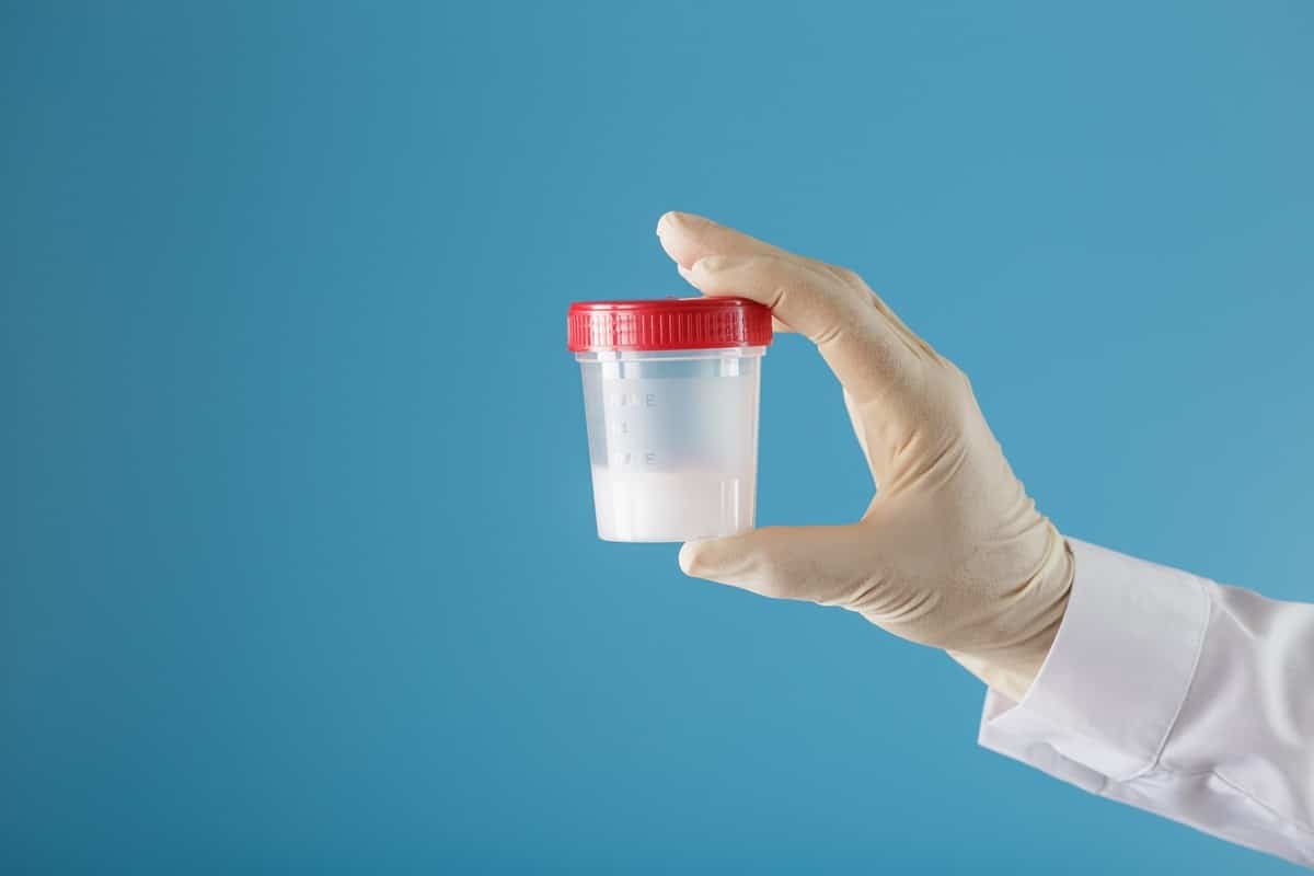Proceso de donación de semen