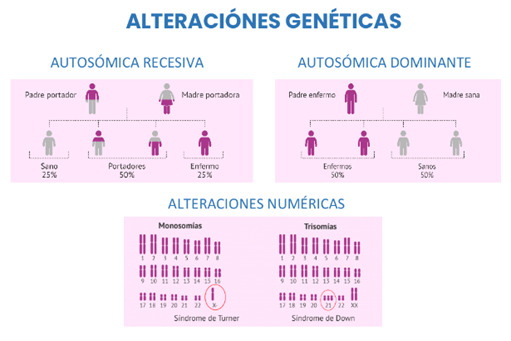 síndrome-de-turner-qué-es-y-cómo-detectarlo