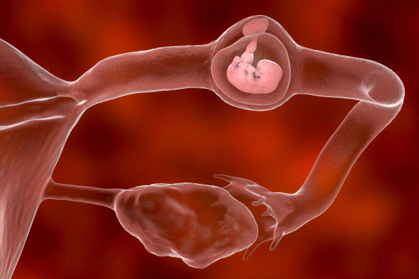 ectopic-pregnancy-embryo-animation-in-tubes