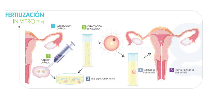 proceso completo de fertilización in vitro