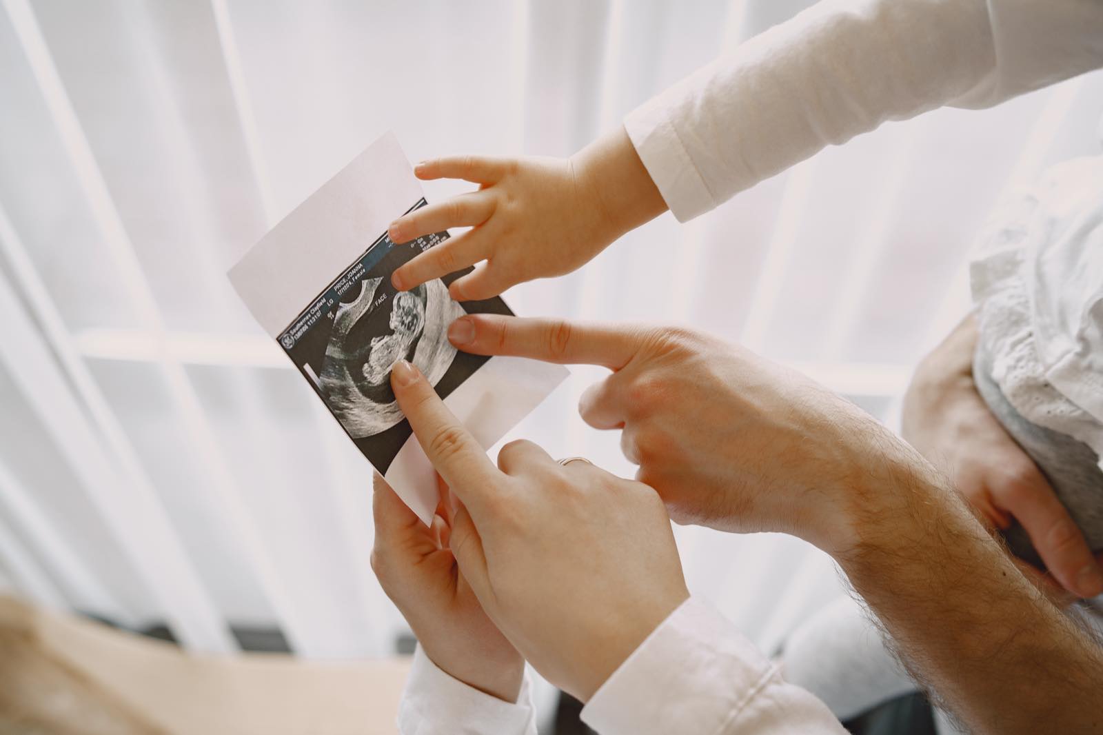 A couple pointing at a printed obstetric ultrasound image