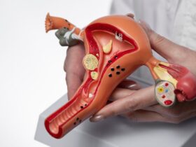 silent-struggle-of-millions-of-woman-everything-you-need-to-know-about-endometriosis-and-how-to-face-it-together-female-sexual-organ-model