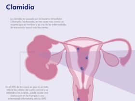 positive-chlamydia-what-to-do